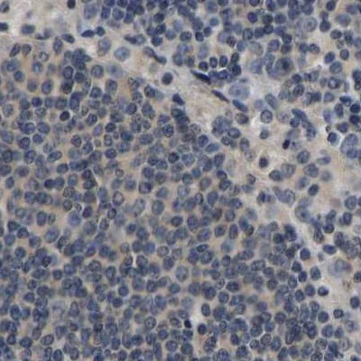 Immunohistochemistry (Formalin/PFA-fixed paraffin-embedded sections) - Anti-RUVBL1 Antibody (AB327199)