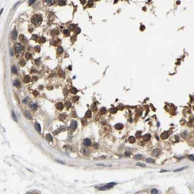 Immunohistochemistry (Formalin/PFA-fixed paraffin-embedded sections) - Anti-RUVBL1 Antibody (AB327199)