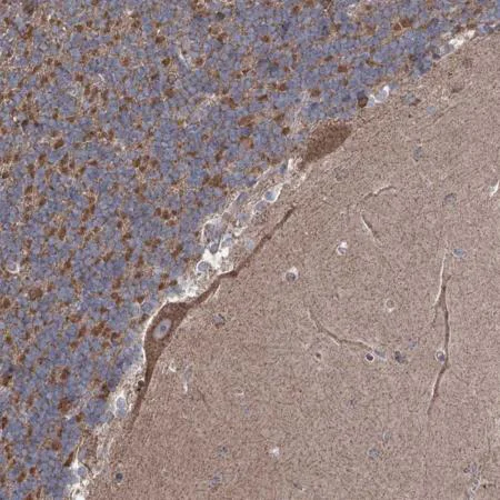 Immunohistochemistry (Formalin/PFA-fixed paraffin-embedded sections) - Anti-RWDD4A antibody (AB204073)