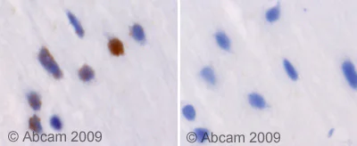 Immunohistochemistry (Formalin/PFA-fixed paraffin-embedded sections) - Anti-RXRG antibody (AB53162)