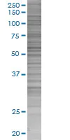 SDS-PAGE - RXRG overexpression 293T lysate (whole cell) (AB94313)