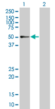 Western blot - RXRG overexpression 293T lysate (whole cell) (AB94313), expandable thumbnail
