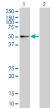 Western blot - RXRG overexpression 293T lysate (whole cell) (AB94313)