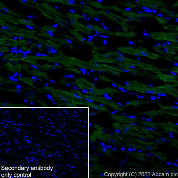 Immunohistochemistry (Frozen sections) - Anti-Ryanodine receptor 2/RYR-2 antibody [EPR26288-70] (AB302716)