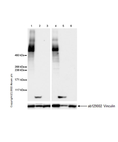 Anti-Ryanodine receptor 2/RYR-2 antibody [EPR26288-70] (ab302716) | Abcam