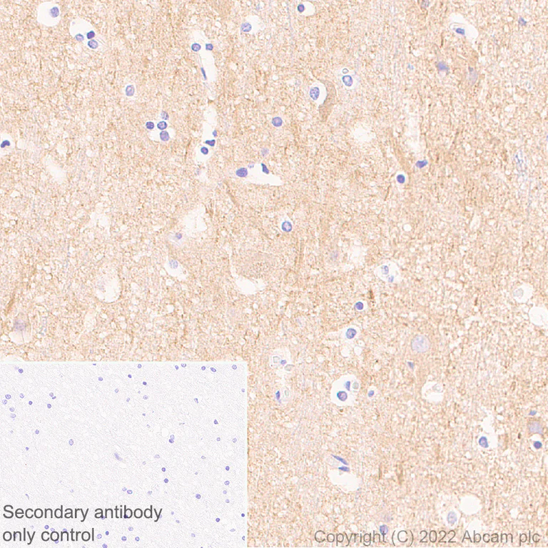 Immunohistochemistry (Formalin/PFA-fixed paraffin-embedded sections) - Anti-Ryanodine receptor 2/RYR-2 antibody [EPR26288-70] - BSA and Azide free (AB302717)