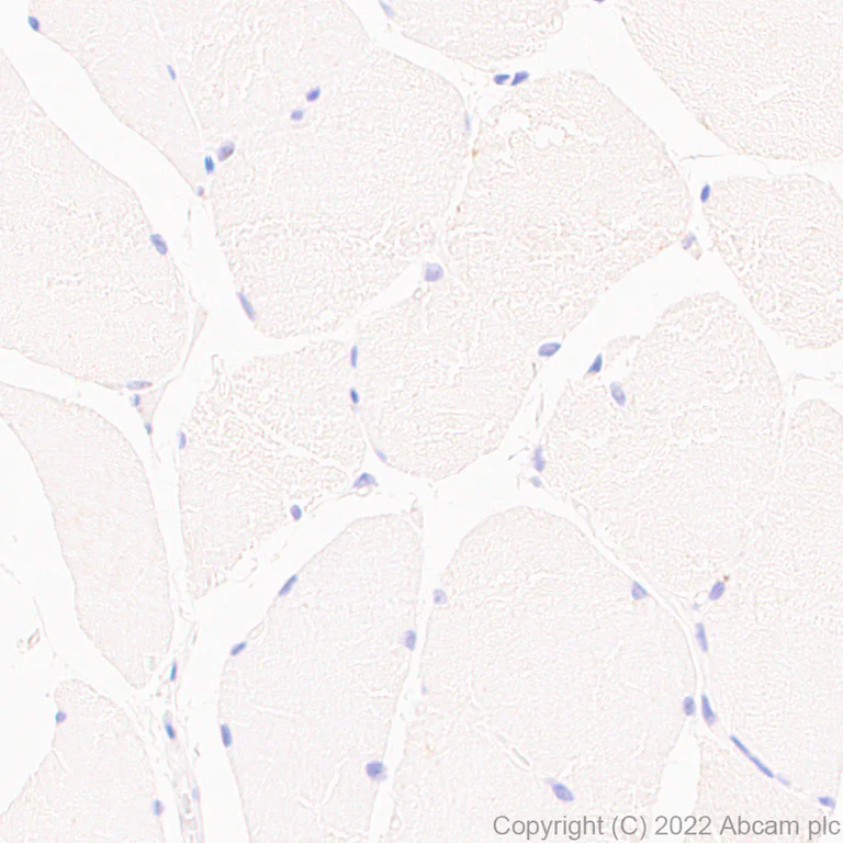Immunohistochemistry (Formalin/PFA-fixed paraffin-embedded sections) - Anti-Ryanodine receptor 2/RYR-2 antibody [EPR26288-70] - BSA and Azide free (AB302717)