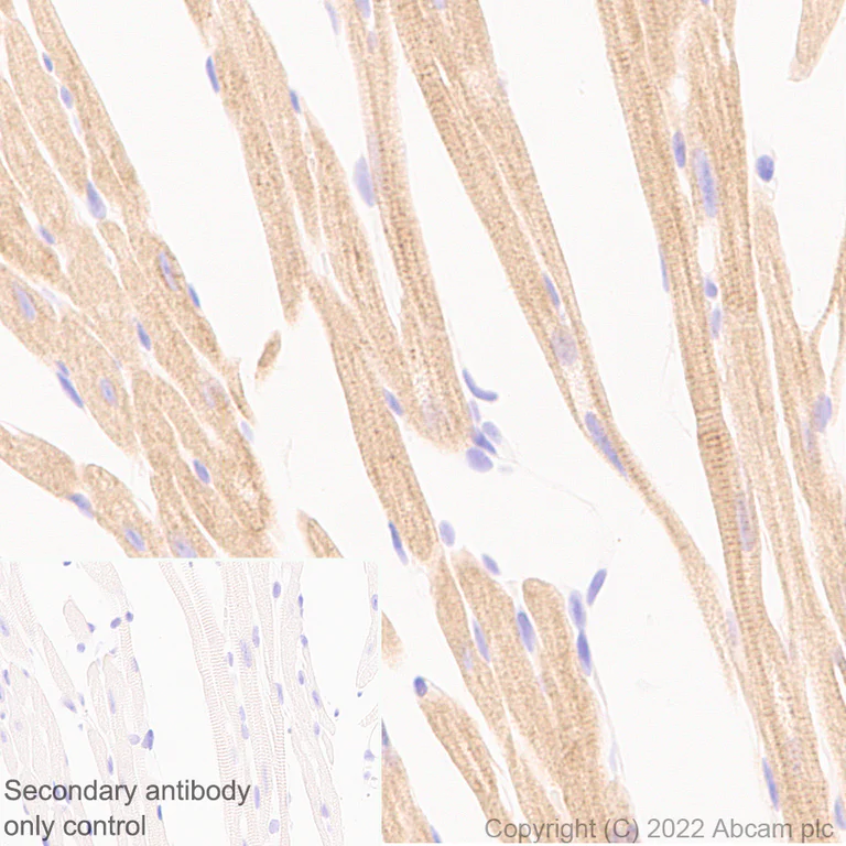 Immunohistochemistry (Formalin/PFA-fixed paraffin-embedded sections) - Anti-Ryanodine receptor 2/RYR-2 antibody [EPR26288-70] - BSA and Azide free (AB302717)