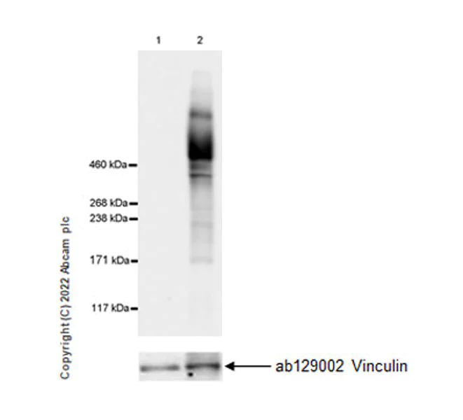 Western blot - Anti-Ryanodine receptor 2/RYR-2 antibody [EPR26288-70] - BSA and Azide free (AB302717)