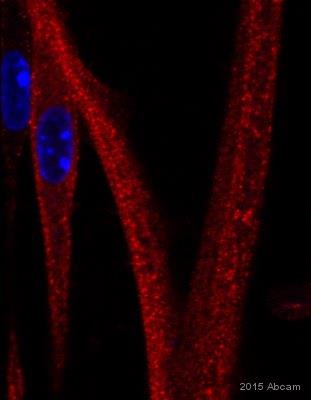 Immunocytochemistry/ Immunofluorescence - Anti-Ryanodine Receptor antibody [34C] (AB2868), expandable thumbnail