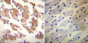 Immunohistochemistry (Formalin/PFA-fixed paraffin-embedded sections) - Anti-Ryanodine Receptor antibody [34C] (AB2868), expandable thumbnail