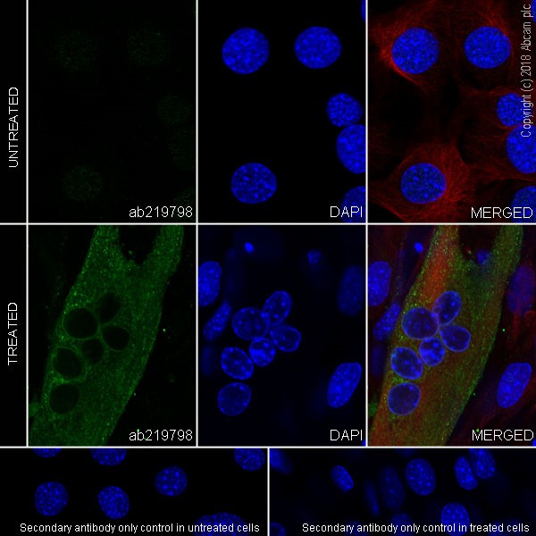 Immunocytochemistry/ Immunofluorescence - Anti-Ryanodine Receptor antibody [EPR21796] - BSA and Azide free (AB231086), expandable thumbnail
