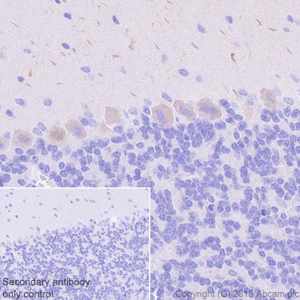 Immunohistochemistry (Formalin/PFA-fixed paraffin-embedded sections) - Anti-Ryanodine Receptor antibody [EPR21796] - BSA and Azide free (AB231086), expandable thumbnail