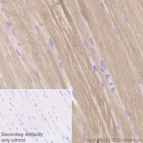 Immunohistochemistry (Formalin/PFA-fixed paraffin-embedded sections) - Anti-Ryanodine Receptor antibody [EPR21796] - BSA and Azide free (AB231086), expandable thumbnail