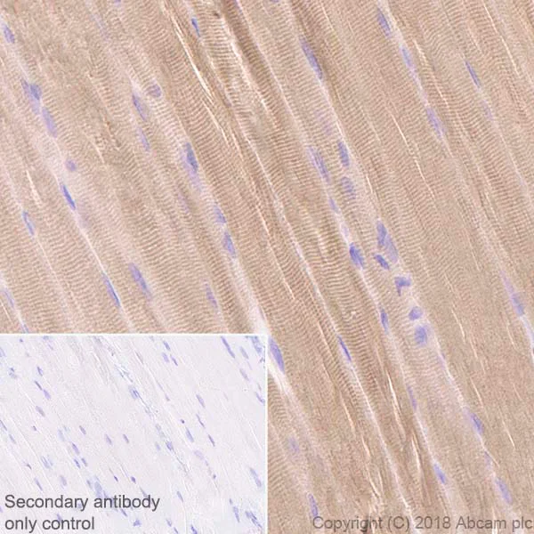 Immunohistochemistry (Formalin/PFA-fixed paraffin-embedded sections) - Anti-Ryanodine Receptor antibody [EPR21796] - BSA and Azide free (AB231086)