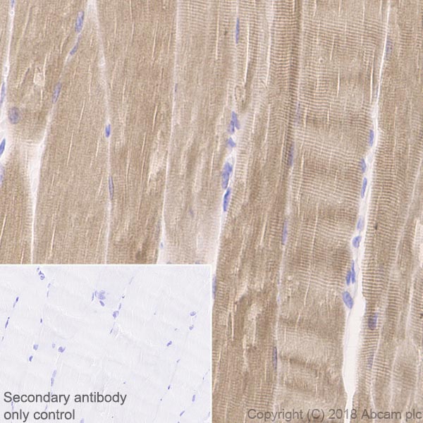 Immunohistochemistry (Formalin/PFA-fixed paraffin-embedded sections) - Anti-Ryanodine Receptor antibody [EPR21796] - BSA and Azide free (ab231086), expandable thumbnail