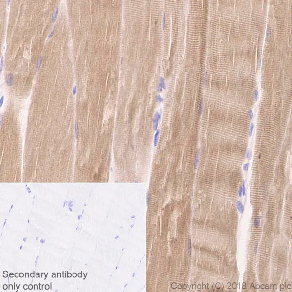 Immunohistochemistry (Formalin/PFA-fixed paraffin-embedded sections) - Anti-Ryanodine Receptor antibody [EPR21796] - BSA and Azide free (AB231086)