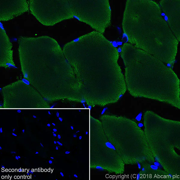 Immunohistochemistry (Frozen sections) - Anti-Ryanodine Receptor antibody [EPR21796] - BSA and Azide free (AB231086)