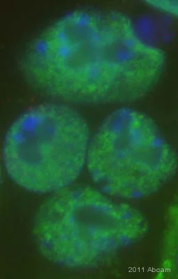 Immunocytochemistry/ Immunofluorescence - Anti-RYBP antibody (AB5976)
