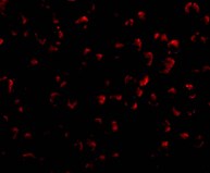 Immunocytochemistry/ Immunofluorescence - Anti-RYBP antibody (AB5976), expandable thumbnail