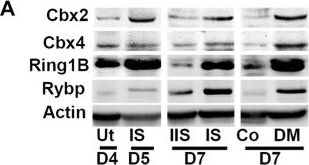 Western blot - Anti-RYBP antibody (AB5976), expandable thumbnail