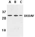 Western blot - Anti-RYBP antibody (AB5976), expandable thumbnail