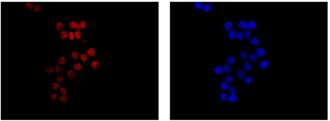 Immunocytochemistry/ Immunofluorescence - Anti-RYBP antibody [EPR13059(2)] - ChIP Grade (ab185971), expandable thumbnail