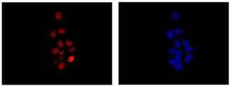 Immunocytochemistry/ Immunofluorescence - Anti-RYBP antibody [EPR13059(2)] - ChIP Grade (ab185971), expandable thumbnail