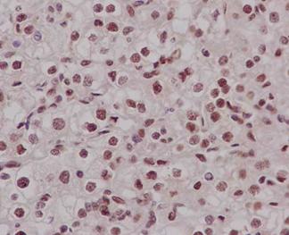Immunohistochemistry (Formalin/PFA-fixed paraffin-embedded sections) - Anti-RYBP antibody [EPR13059(2)] - ChIP Grade (AB185971), expandable thumbnail