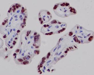Immunohistochemistry (Formalin/PFA-fixed paraffin-embedded sections) - Anti-RYBP antibody [EPR13059(2)] - ChIP Grade (ab185971), expandable thumbnail