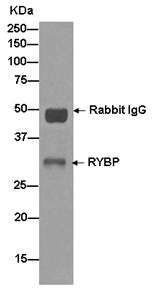 Immunoprecipitation - Anti-RYBP antibody [EPR13059(2)] - ChIP Grade (ab185971), expandable thumbnail