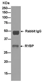 Immunoprecipitation - Anti-RYBP antibody [EPR13059(2)] - ChIP Grade (AB185971)