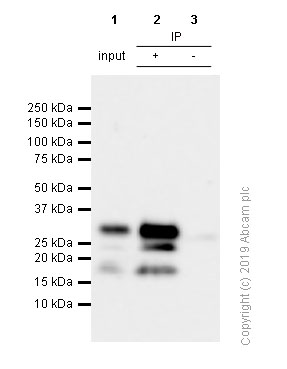 Immunoprecipitation - Anti-RYBP antibody [EPR13059(2)] - ChIP Grade (AB185971), expandable thumbnail