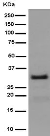 Western blot - Anti-RYBP antibody [EPR13059(2)] - ChIP Grade (AB185971)