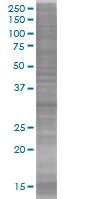 SDS-PAGE - RYBP overexpression 293T lysate (whole cell) (AB94243)