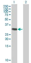 Western blot - RYBP overexpression 293T lysate (whole cell) (AB94243)
