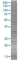 RYBP overexpression 293T lysate (whole cell)