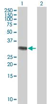 Western blot - RYBP overexpression 293T lysate (whole cell) (AB94244)