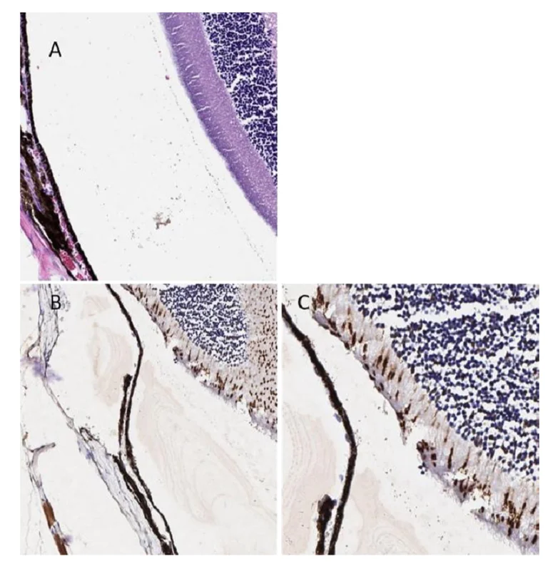 Immunohistochemistry (Formalin/PFA-fixed paraffin-embedded sections) - Anti-S Opsin/BCP antibody (AB235274)