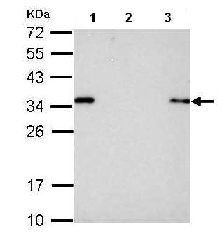 Immunoprecipitation - Anti-S tag antibody (AB183674), expandable thumbnail