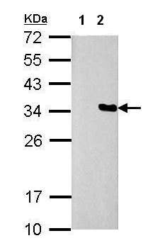 Western blot - Anti-S tag antibody (AB183674), expandable thumbnail