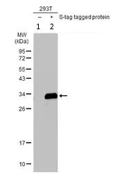 Western blot - Anti-S tag antibody (AB183674)