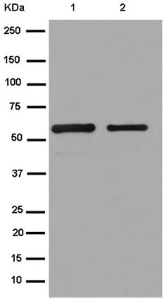 Western blot - Anti-S tag antibody [EPR12996] (AB180958)