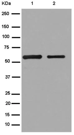 Western blot - Anti-S tag antibody [EPR12996] (AB180958)