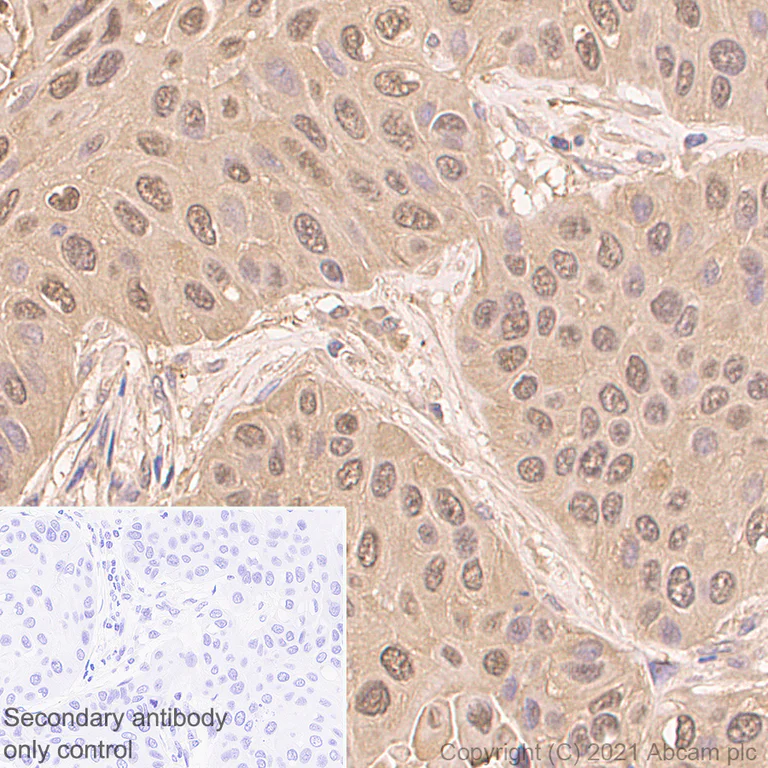 Immunohistochemistry (Formalin/PFA-fixed paraffin-embedded sections) - Anti-S100 alpha 2/S100A2 antibody [EPR5392] - BSA and Azide free (AB247877)
