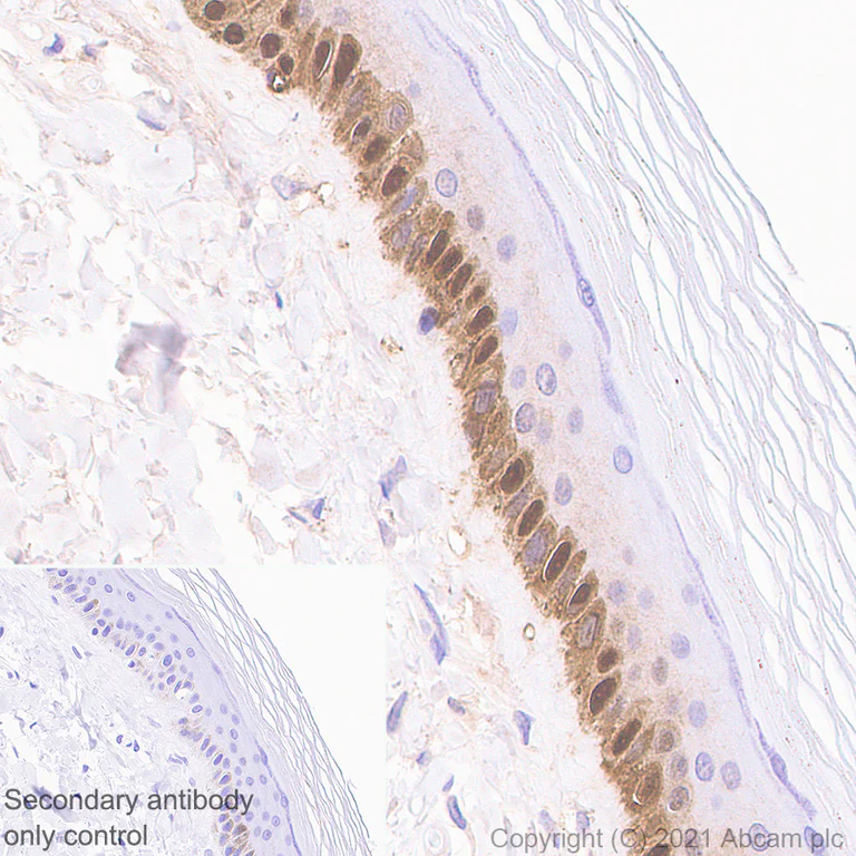Immunohistochemistry (Formalin/PFA-fixed paraffin-embedded sections) - Anti-S100 alpha 2/S100A2 antibody [EPR5392] - BSA and Azide free (AB247877)