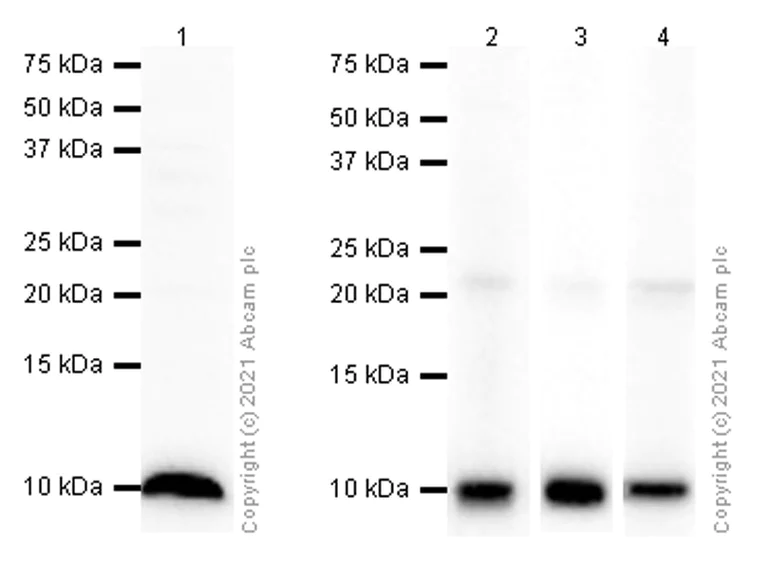 Western blot - Anti-S100 alpha 2/S100A2 antibody [EPR5392] - BSA and Azide free (AB247877)