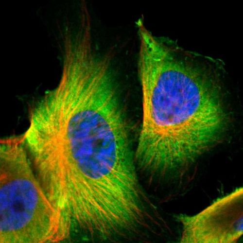 Immunocytochemistry/ Immunofluorescence - Anti-S100 alpha 6/PRA antibody (AB244301)