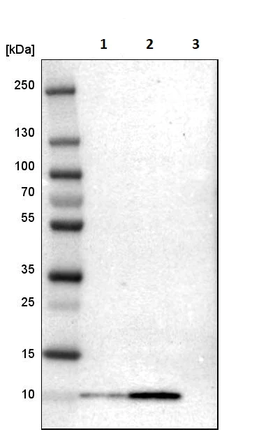 Western blot - Anti-S100 alpha 6/PRA antibody (AB244301)