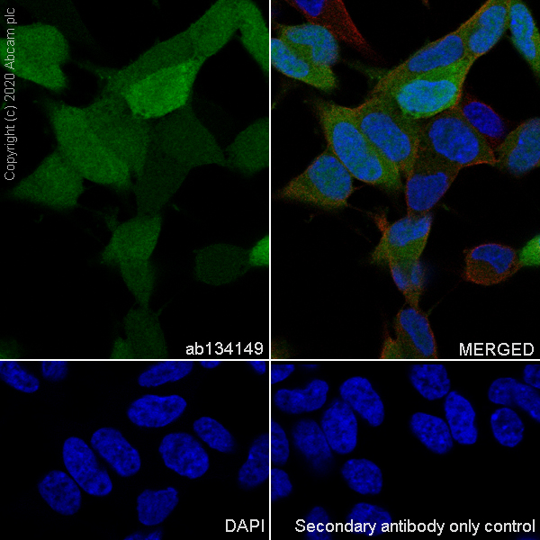 Immunocytochemistry/ Immunofluorescence - Anti-S100 alpha 6/PRA antibody [EPNCIR121] (AB134149), expandable thumbnail